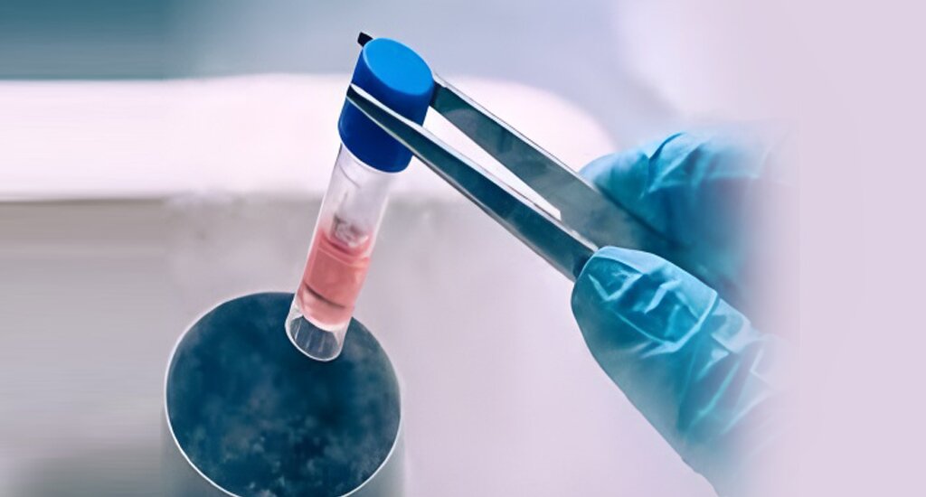 中国供卵机构：试管诊前准备及移植解说